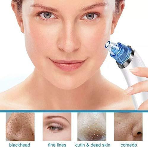 Pore Cleaning & Blackhead Removal Device
